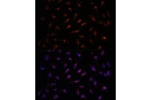 Immunofluorescence analysis of U-2 OS cells using DNTTIP2 antibody (ABIN7266732) at dilution of 1:100. (DNTTIP2 抗体  (AA 1-300))