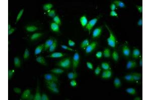Immunofluorescence staining of Hela cells with ABIN7167474 at 1:133, counter-stained with DAPI. (RIPK2 抗体  (AA 1-540))