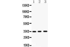 Anti- NKX2 Picoband antibody, Western blotting All lanes: Anti NKX2  at 0. (NK2 Homeobox 5 抗体  (Middle Region))