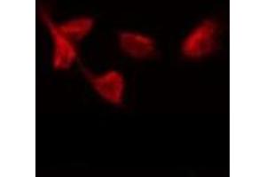 ABIN6275663 staining Hela by IF/ICC. (UBAP2L 抗体  (Internal Region))