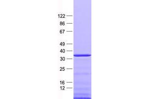 Western Blotting (WB) image for NK2 Homeobox 2 (Nkx2-2) protein (His tag) (ABIN2727352)