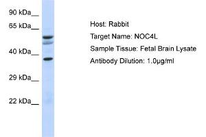 Host: Rabbit Target Name: NOC4L Sample Type: Fetal Brain lysates Antibody Dilution: 1. (NOC4L 抗体  (N-Term))