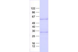 Validation with Western Blot