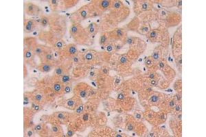 Used in DAB staining on fromalin fixed paraffin- embedded Kidney tissue (LYPLA1 抗体  (AA 1-230))