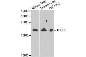 Western blot analysis of extracts of various cell lines, using TPPP3 antibody. (TPPP3 抗体)