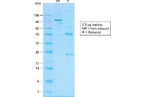 SDS-PAGE Analysis of Purified CD20 Rabbit Recombinant Monoclonal Antibody (IGEL/1497R). (Recombinant CD20 抗体)
