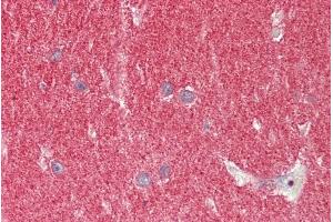 ABIN1049516 (5µg/ml) staining of paraffin embedded Human Cerebellum. (SNCA 抗体  (Internal Region))