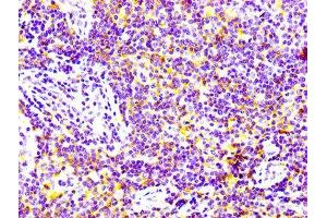 IHC image of ABIN7127287 diluted at 1:100 and staining in paraffin-embedded human lymph node tissue performed on a Leica BondTM system. (Recombinant CD97 抗体)