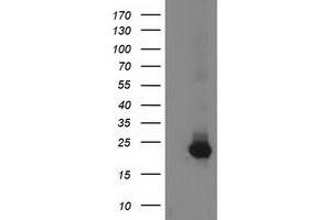 Western Blotting (WB) image for anti-Guanylate Kinase 1 (GUK1) antibody (ABIN1498566) (GUK1 抗体)