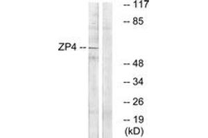 Western blot analysis of extracts from Jurkat cells, using ZP4 Antibody. (ZP4 抗体  (AA 231-280))
