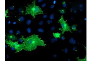 Anti-OSBP mouse monoclonal antibody (ABIN2454755) immunofluorescent staining of COS7 cells transiently transfected by pCMV6-ENTRY OSBP (RC204250). (OSBP 抗体)