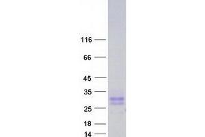 Western Blotting (WB) image for CD99 Molecule-Like 2 (CD99L2) (Transcript Variant 4) protein (Myc-DYKDDDDK Tag) (ABIN2713825)
