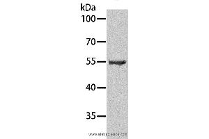 Western blot analysis of Human testis tissue, using SPATA6 Polyclonal Antibody at dilution of 1:1000 (SPATA6 抗体)