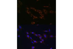 Immunofluorescence analysis of NIH/3T3 cells using  Rabbit pAb (ABIN7265726) at dilution of 1:100 (40x lens).