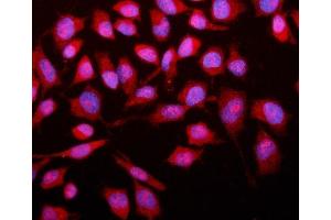 IF analysis of SMAD2 using anti-SMAD2 antibody (ABIN6719361). (SMAD2 抗体  (AA 83-264))