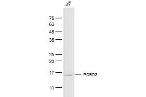 Ray eye lysates probed with PCBD2 Polyclonal Antibody, Unconjugated  at 1:300 dilution and 4˚C overnight incubation.