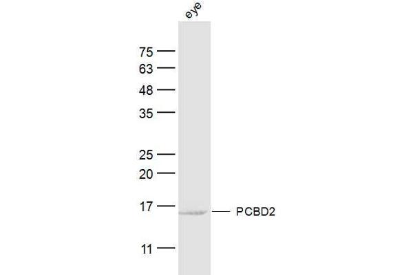 PCBD2 anticorps  (AA 31-130)