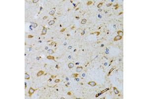 Immunohistochemistry of paraffin-embedded mouse brain using SRP19 antibody (ABIN2560139) at dilution of 1:100 (40x lens). (SRP19 抗体)