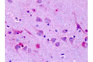 Immunohistochemistry (IHC) image for anti-Olfactory Receptor, Family 6, Subfamily N, Member 1 (OR6N1) (Extracellular Domain) antibody (ABIN1049188)