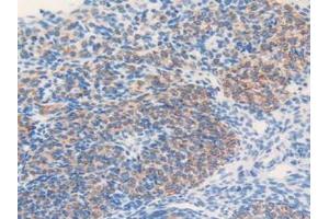 Detection of MGST1 in Mouse Ovary Tissue using Polyclonal Antibody to Microsomal Glutathione S Transferase 1 (MGST1) (MGST1 抗体  (AA 8-155))
