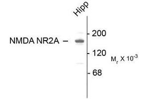 Image no. 1 for anti-Glutamate Receptor, Ionotropic, N-Methyl D-Aspartate 2a (GRIN2A) (C-Term) antibody (ABIN372679) (NMDAR2A 抗体  (C-Term))
