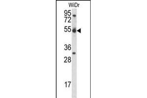 CCNI Antibody (C-term) (ABIN656962 and ABIN2846146) western blot analysis in WiDr cell line lysates (35 μg/lane). (Cyclin I 抗体  (C-Term))
