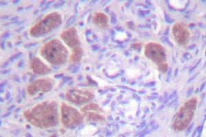 Image no. 1 for anti-Neutrophil Cytosolic Factor 4, 40kDa (NCF4) antibody (ABIN272048)