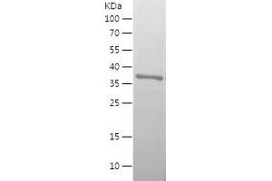 Western Blotting (WB) image for Insulin-Like Growth Factor Binding Protein 3 (IGFBP3) (AA 120-244) protein (His tag) (ABIN7123460) (IGFBP3 Protein (AA 120-244) (His tag))