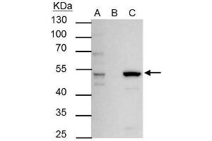 IP Image ERR alpha antibody immunoprecipitates ERR alpha protein in IP experiments. (ESRRA 抗体)