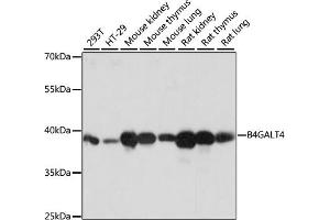 Western blot analysis of extracts of various cell lines, using B4G antibody (ABIN7271200) at 1:1000 dilution. (B4GALT4 抗体  (AA 35-344))