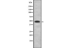 Western Blotting (WB) image for anti-Melanoma Antigen Family A, 1 (Directs Expression of Antigen MZ2-E) (MAGEA1) (N-Term) antibody (ABIN6263074)