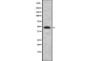 Western blot analysis of MAGEA1 using K562 whole cell lysates (MAGEA1 抗体  (N-Term))