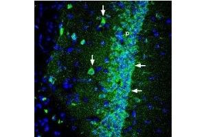 Immunohistochemistry (IHC) image for anti-SH3 and Multiple Ankyrin Repeat Domains 1 (SHANK1) (AA 614-628), (Intracellular) antibody (ABIN7043626)