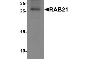 Western blot analysis of RAB21 in mouse kidney tissue lysate with RAB21 antibody at 1 µg/mL. (RAB21 抗体  (C-Term))