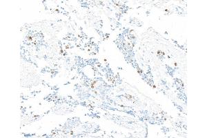 Immunohistochemistry (IHC) image for anti-Cyclin A2 (CCNA2) (C-Term) antibody (ABIN7795812)