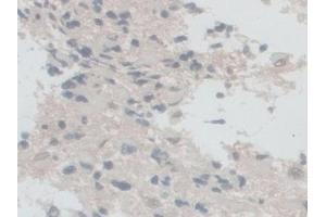 Immunohistochemistry (IHC) image for anti-NADPH Oxidase 5 (NOX5) (AA 456-765) antibody (ABIN7444193)