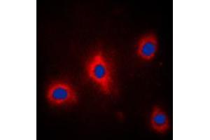 Immunofluorescent analysis of GRB10 (pY67) staining in PC12 cells. (GRB10 抗体  (N-Term, pTyr67))