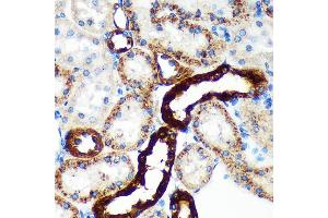 Immunohistochemistry (IHC) image for anti-Echinoderm Microtubule Associated Protein Like 4 (EML4) (AA 360-560) antibody (ABIN7266891)