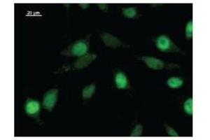 Immunostaining analysis in HeLa cells. (ZNF384 抗体)