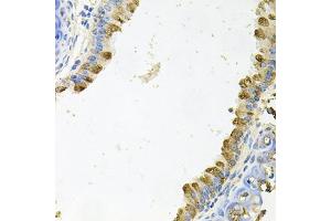 Immunohistochemistry of paraffin-embedded mouse lung using KLK11 antibody (ABIN6129404, ABIN6142947, ABIN6142949 and ABIN6222337) at dilution of 1:100 (40x lens). (Kallikrein 11 抗体  (AA 1-250))