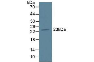 Figure. (TMEM27 抗体  (AA 12-222))