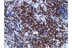 Immunohistochemical staining of paraffin-embedded Human lymph node tissue using anti-PIK3AP1 mouse monoclonal antibody. (PIK3AP1 抗体)
