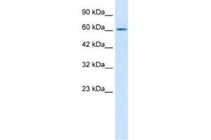 Western Blotting (WB) image for anti-TRIM17 / RNF16 (TRIM17) antibody (ABIN2460981) (TRIM17 / RNF16 抗体)