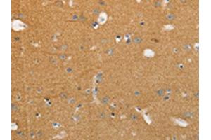 The image on the left is immunohistochemistry of paraffin-embedded Human brain tissue using ABIN7191634(NFASC Antibody) at dilution 1/30, on the right is treated with synthetic peptide. (NFASC 抗体)