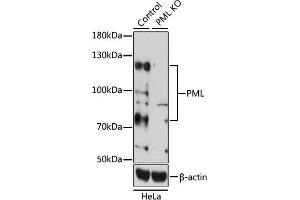 Western blot analysis of extracts from normal (control) and PML knockout (KO) HeLa cells, using PML antibody (ABIN3021658, ABIN3021659, ABIN3021660, ABIN1513388 and ABIN1514534) at 1:1000 dilution. (PML 抗体  (AA 300-600))