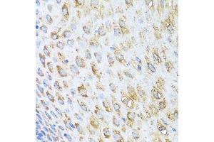 Immunohistochemistry of paraffin-embedded human esophagus using STK4 antibody. (STK4 抗体  (AA 303-487))