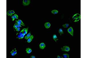 Immunofluorescent analysis of MCF-7 cells using ABIN7142312 at dilution of 1:100 and Alexa Fluor 488-congugated AffiniPure Goat Anti-Rabbit IgG(H+L) (HSD17B7 抗体  (AA 128-198))