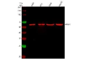 Western blot analysis of PTBP1 using anti-PTBP1 antibody (ABIN7599451).