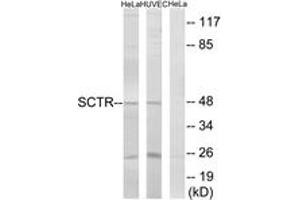 Western blot analysis of extracts from HeLa/HuvEc cells, using SCTR Antibody. (SCTR 抗体  (AA 100-149))