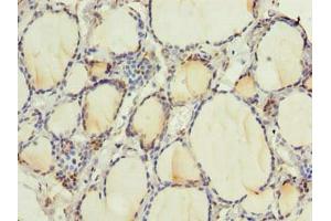 Immunohistochemistry of paraffin-embedded human thyroid tissue using ABIN7168256 at dilution of 1:100 (RNF24 抗体  (AA 45-148))